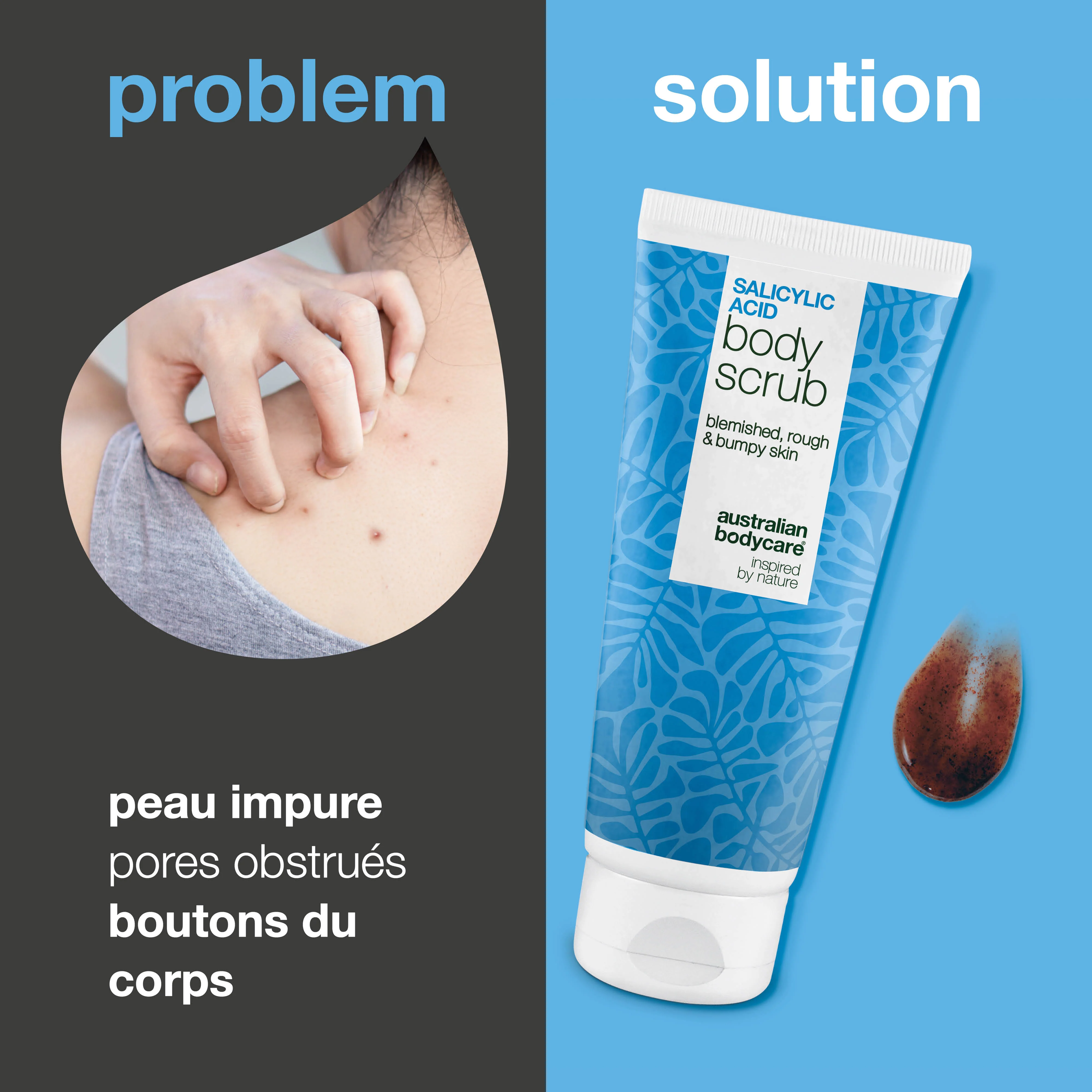 Gommage Corps à l’Acide Salicylique pour une peau lisse et purifiée — Gommage Corps à l’Acide Salicylique élimine boutons et impuretés. Avec acide salicylique, acide glycolique et allantoïne. - Image 2