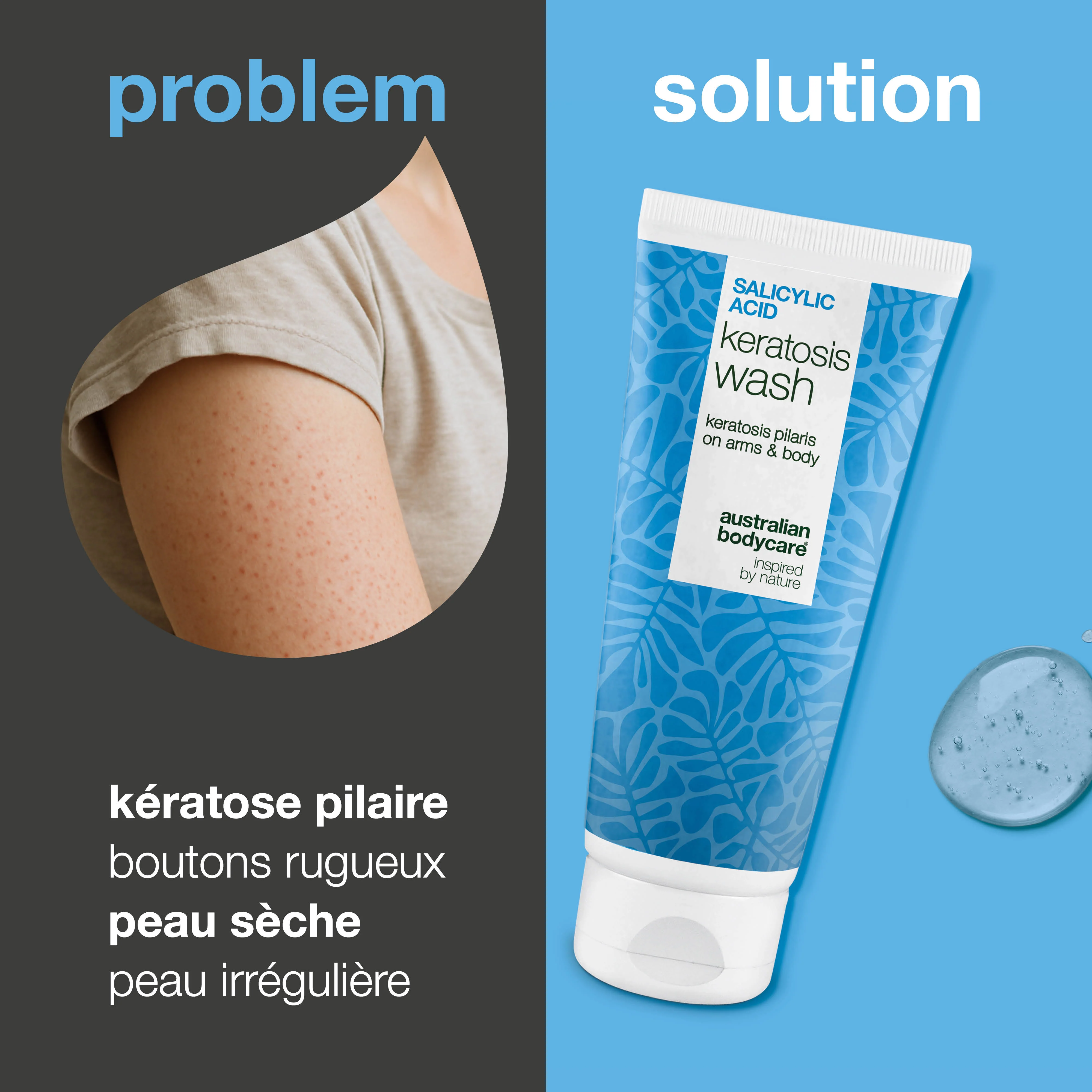 Kératose Pilaire Gel Douche – pour peau rugueuse et bosses — Kératose Pilaire Gel Douche contre la kératose pilaire, peau sèche et bosselée. Avec acide salicylique, niacinamide et glycérine. - Image 2