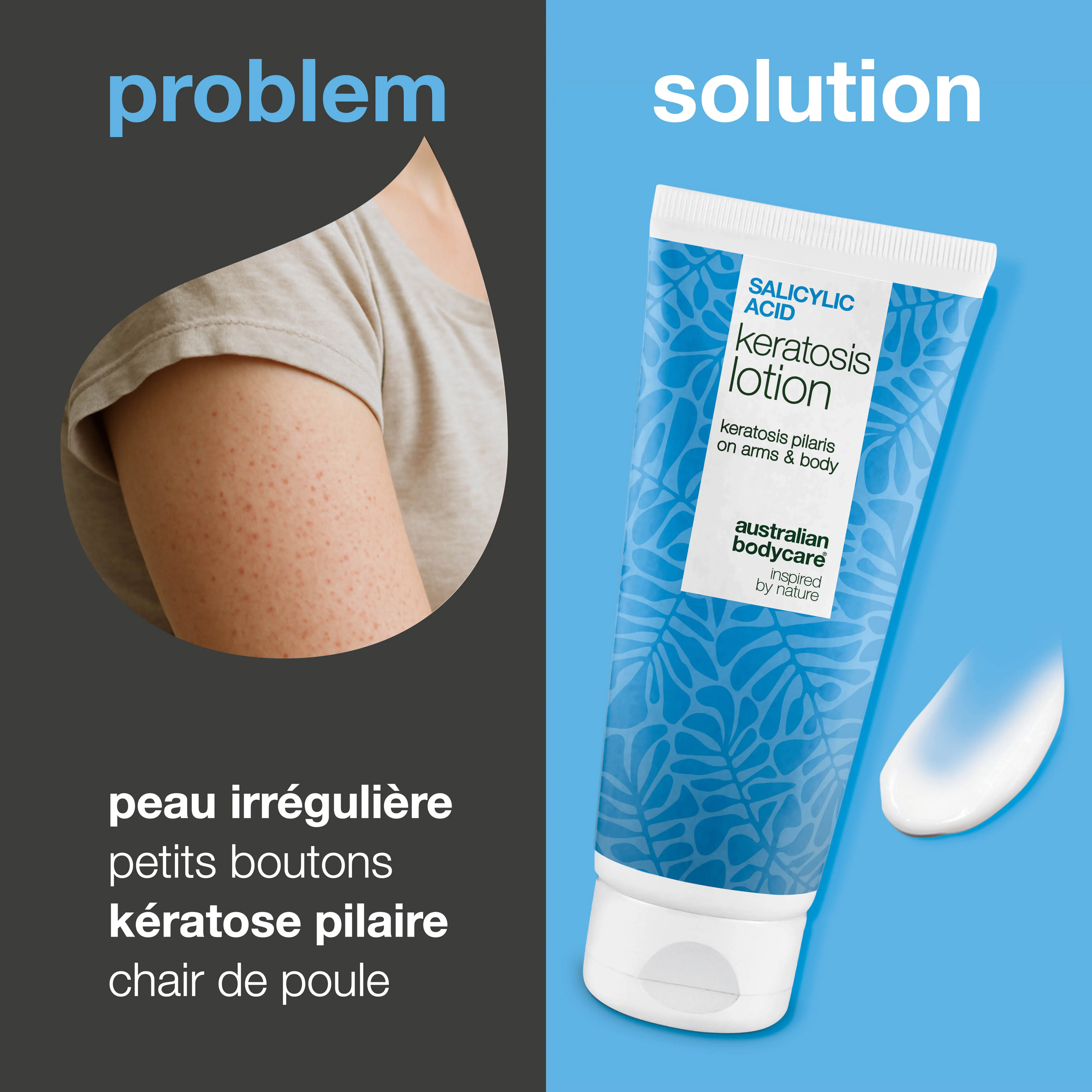 Lotion corps kératose pilaire et peau sèche granuleuse — Lotion pour kératose pilaire et peau sèche. Lisse avec acide salicylique, niacinamide et zinc. - Image 2