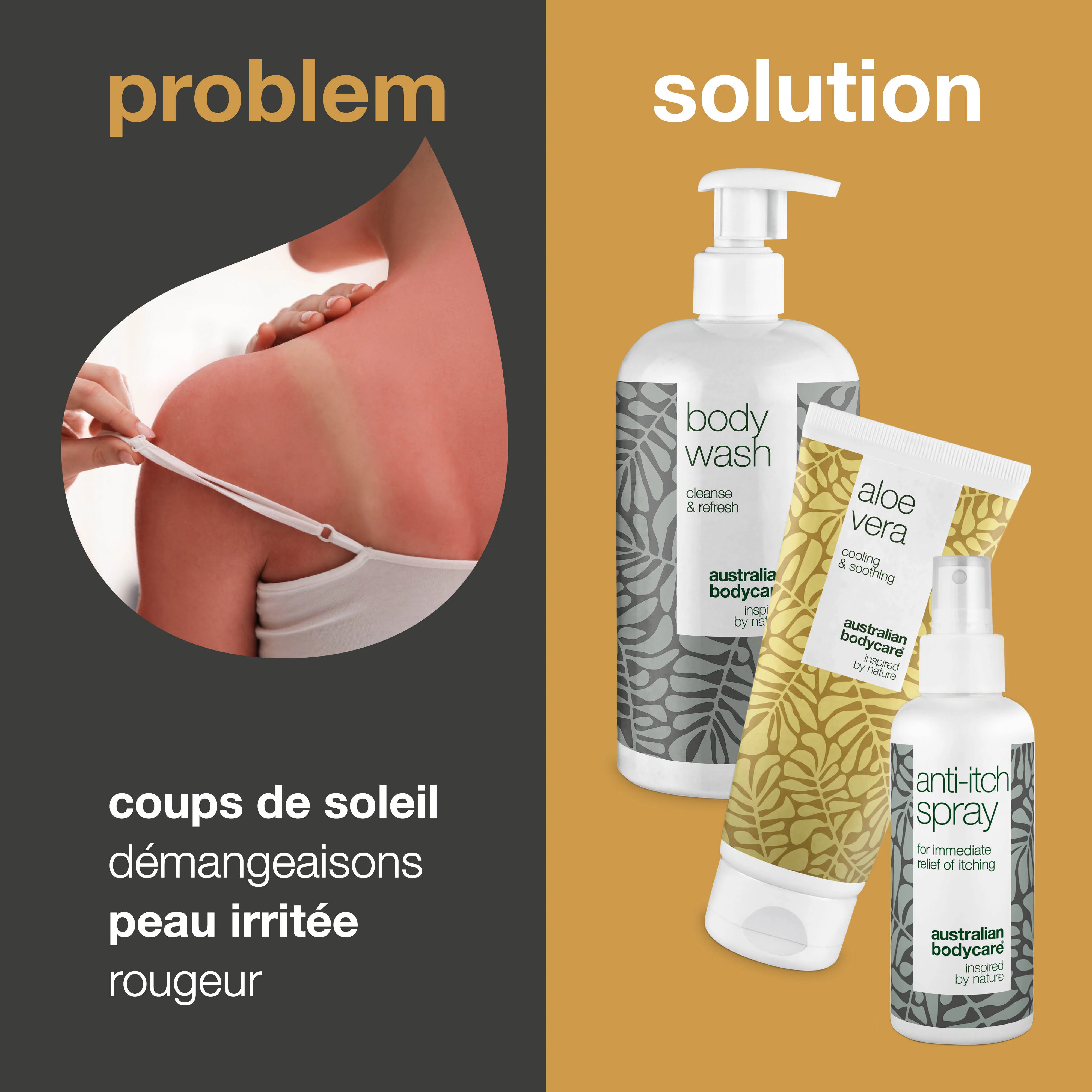 3 produits après–soleil pour les peaux rouges et les coups de soleil — pour les coups de soleil, la peau qui pique et l'eczéma solaire - Image 2