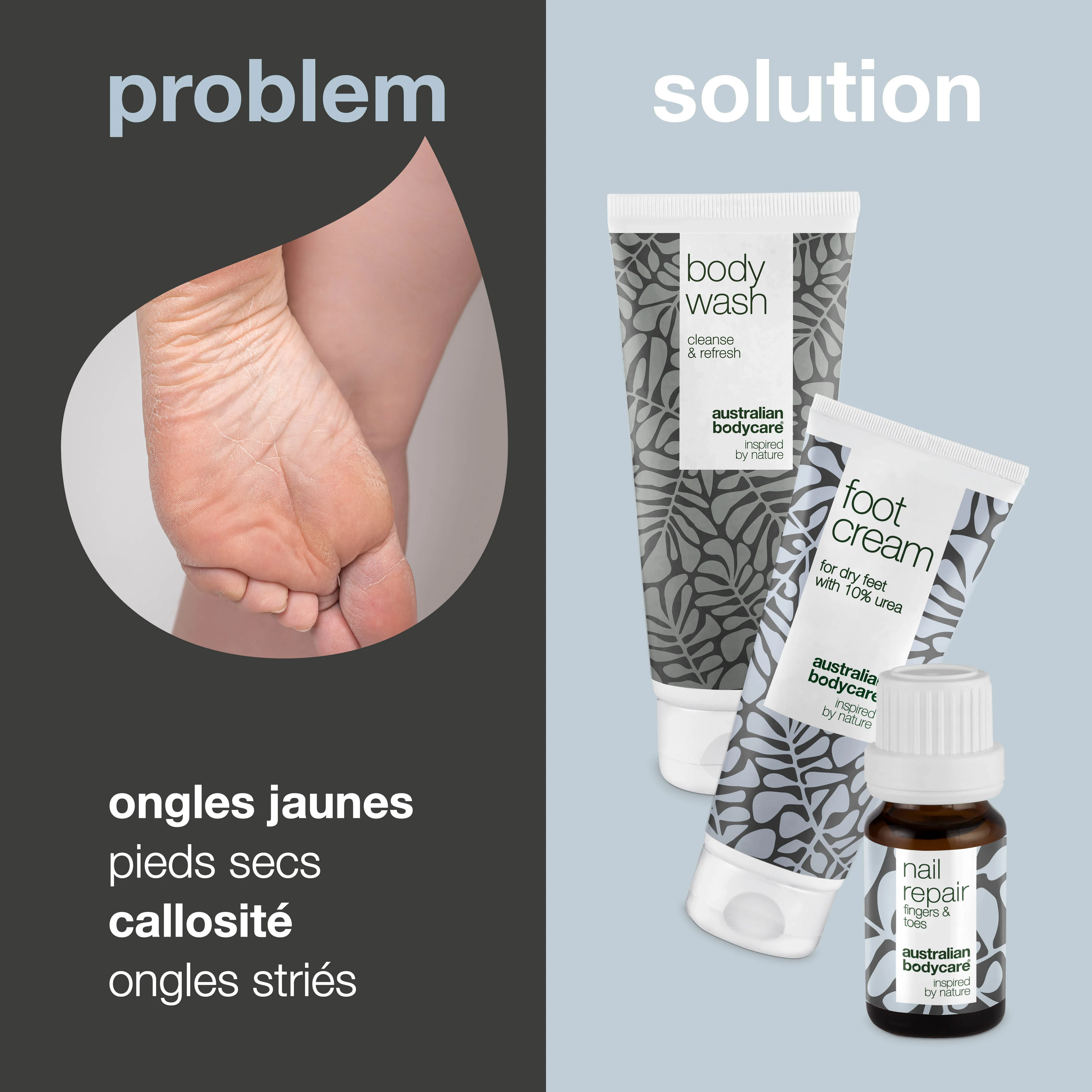 Kit de soins des pieds — 3 produits pour le soin quotidien des pieds secs et des ongles jaunis - Image 2