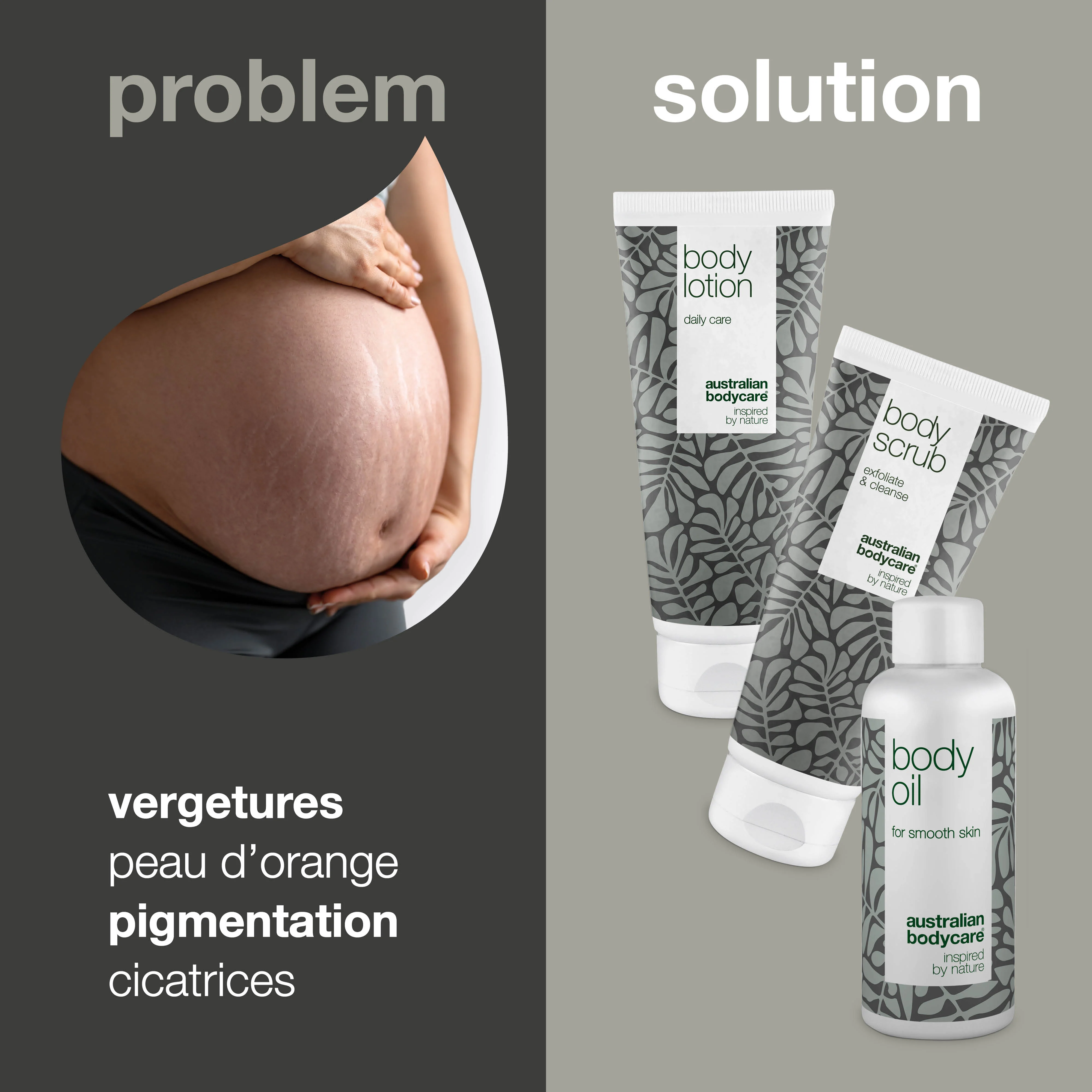 Kit de 3 produits pour les vergetures — 3 produits pour réduire la visibilité des vergetures et des cicatrices - Image 2