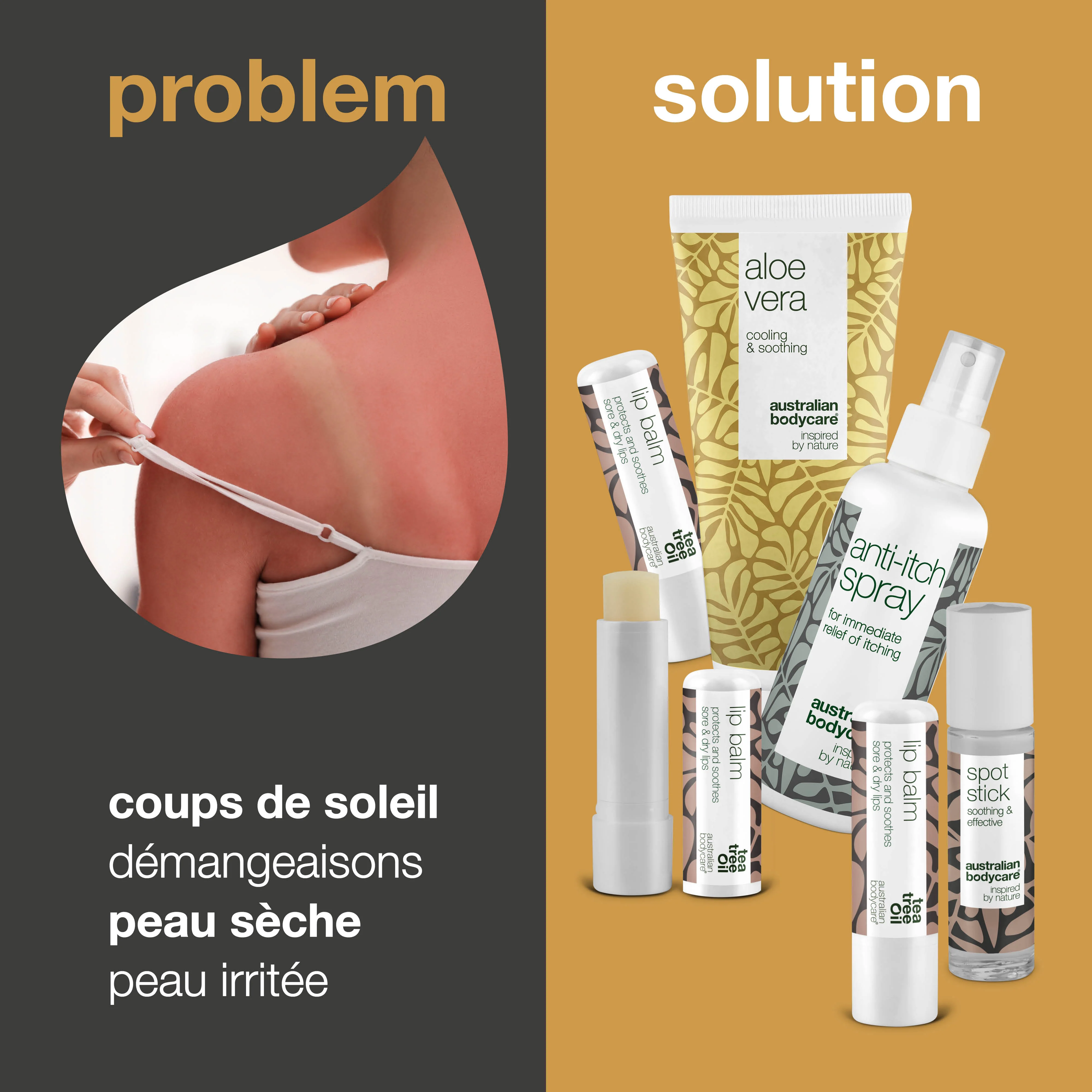 Kit de 4 produits pour l'été — Produits pour soigner les coups de soleil ou autres problèmes de peau - Image 2