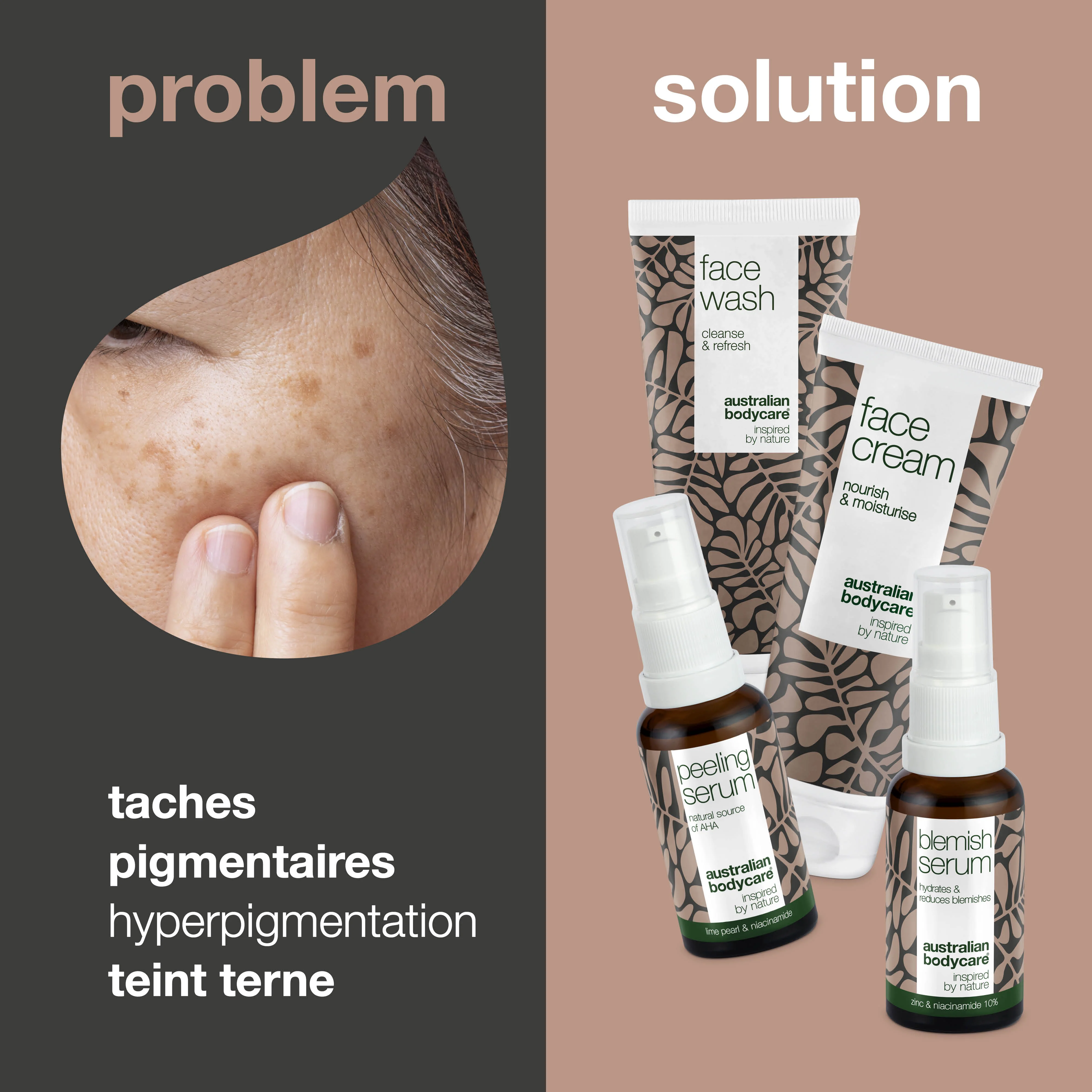 Kit de produits pour aider les soins de pigmentations du visage — Réduit les problèmes de pigmentation du visage - Image 2
