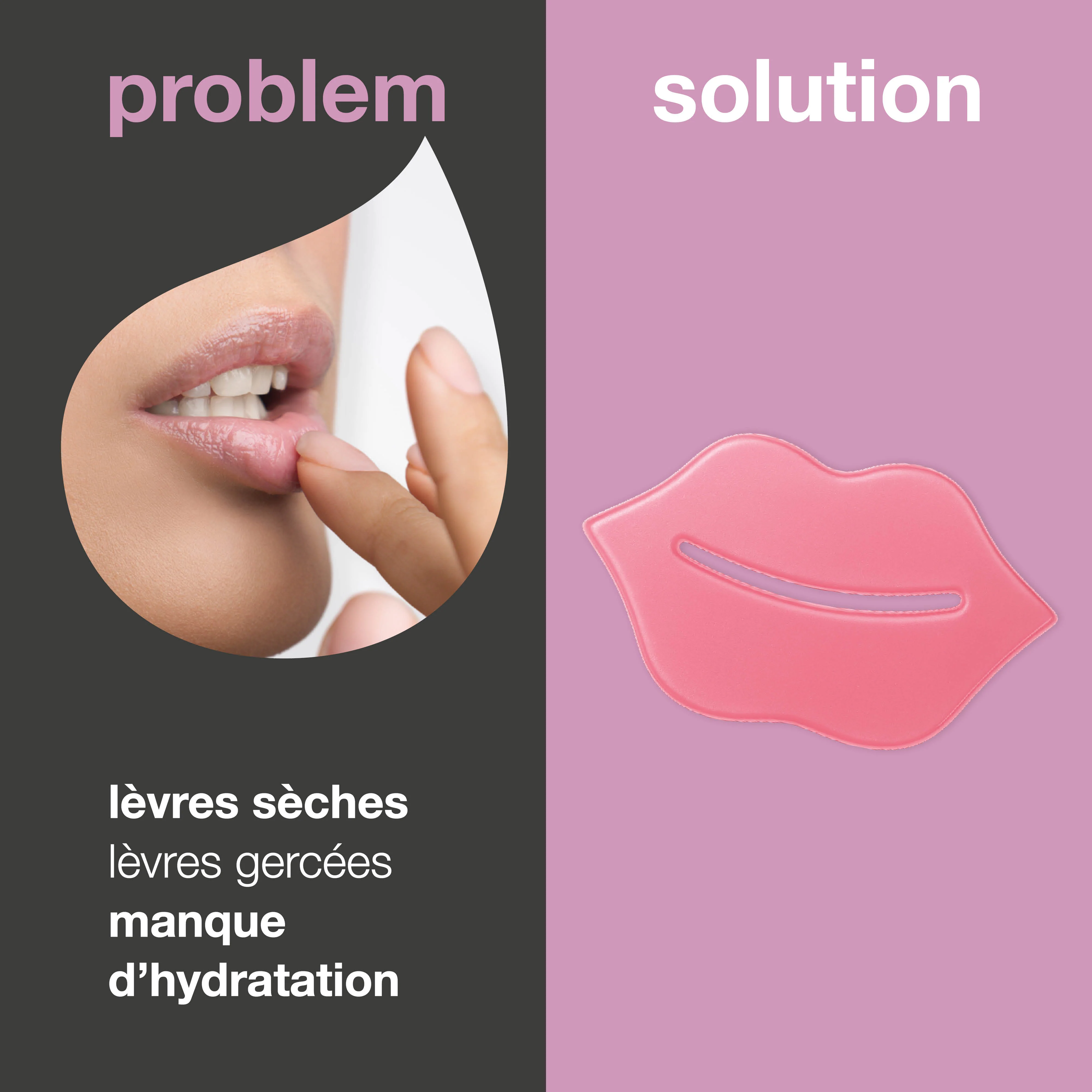 Masque lèvres pour lèvres sèches et gercées – avec B12 — Masque lèvres pour lèvres sèches et abîmées. Hydrate et régénère avec B12, collagène et acide hyaluronique. - Image 2